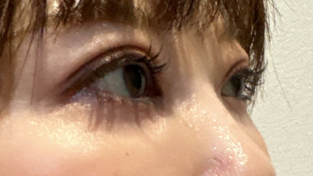 手术前的状态 其一