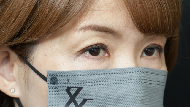 手術前の状態 その1