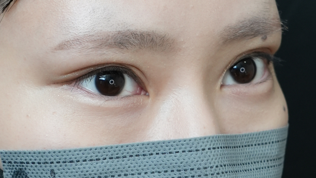 Postoperative Condition Part 1