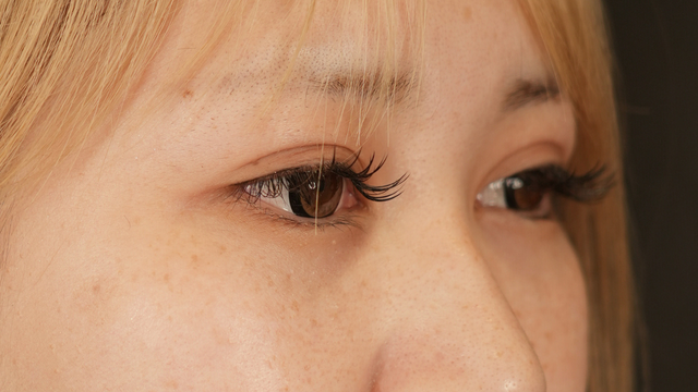 Postoperative Condition Part 1