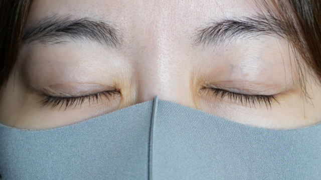 手术前的状态 其一