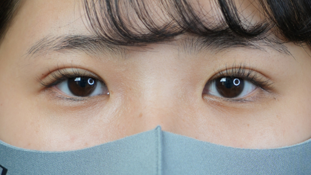 手术前的状态 其一