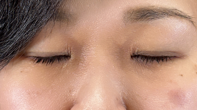 Postoperative Condition Part 1