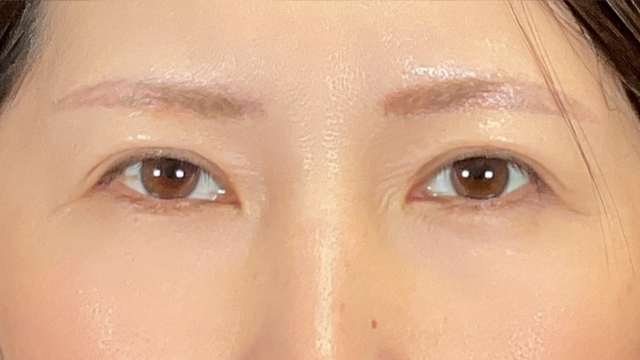 Postoperative Condition Part 1