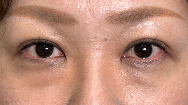 Postoperative Condition Part 1