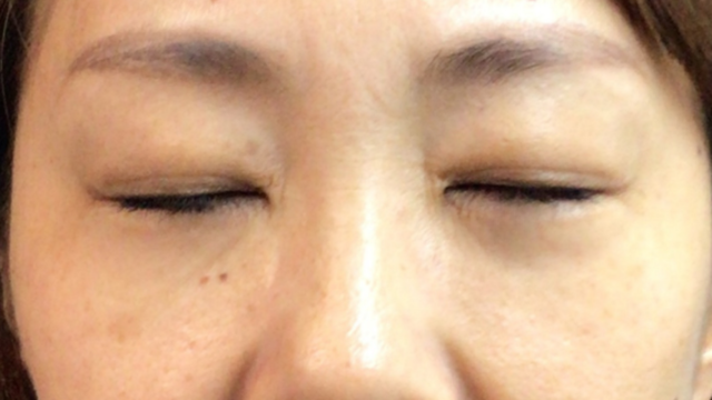 Postoperative Condition Part 1