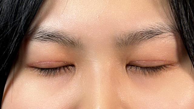 手术前的状态 其一