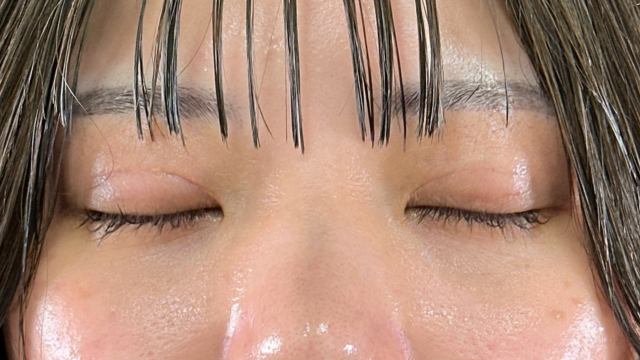 Postoperative Condition Part 1