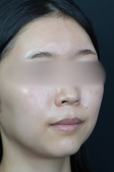 Postoperative Condition Part 1