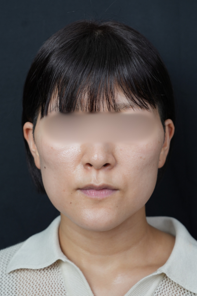 手术前的状态 其一