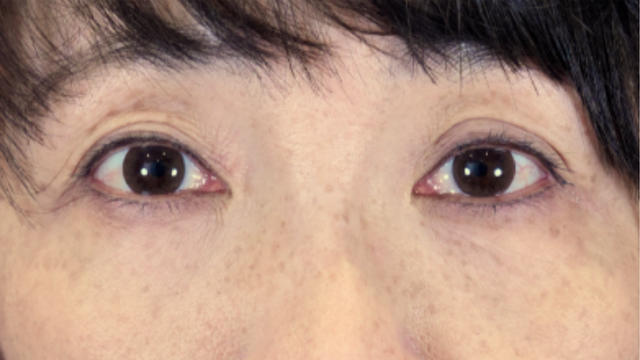 手术前的状态 其一