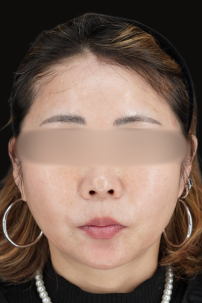 手術前の状態 その1