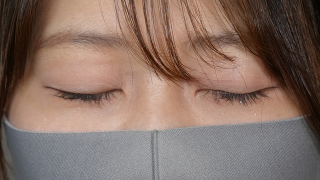 Postoperative Condition Part 1