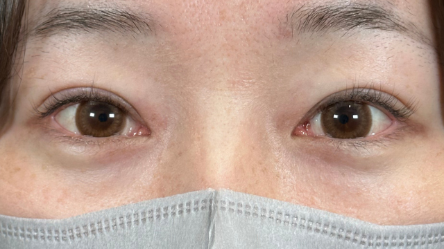 手术前的状态 其一