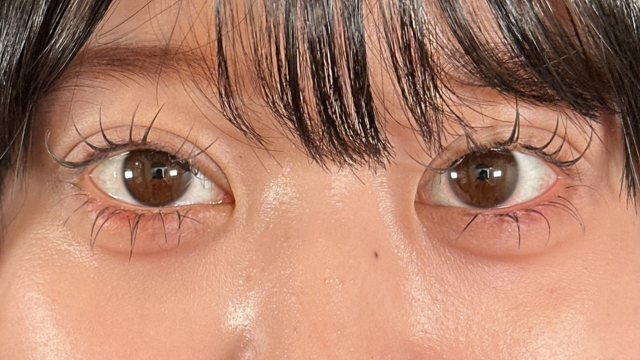 手術前の状態 その1