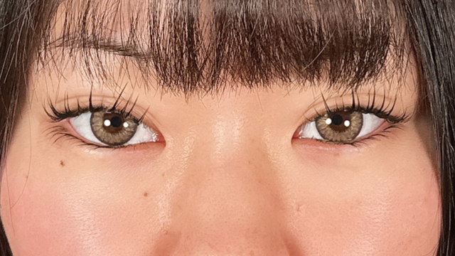 手术前的状态 其一