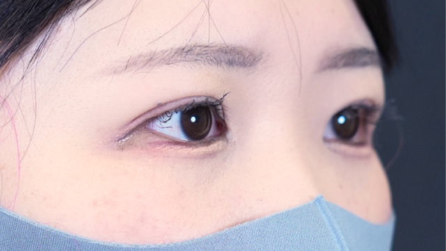 Postoperative Condition Part 1