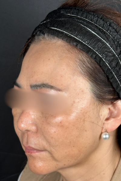 手術前の状態 その1