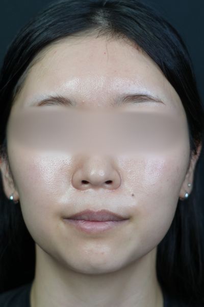 Postoperative Condition Part 1