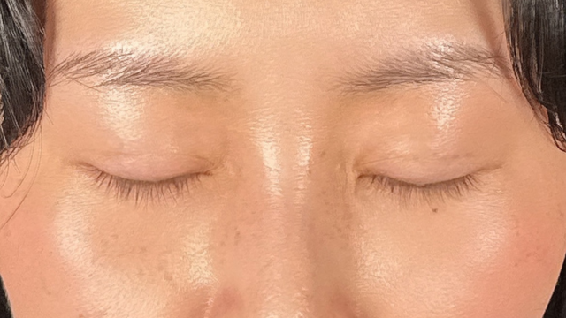 手术前的状态 其一