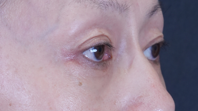 Postoperative Condition Part 1