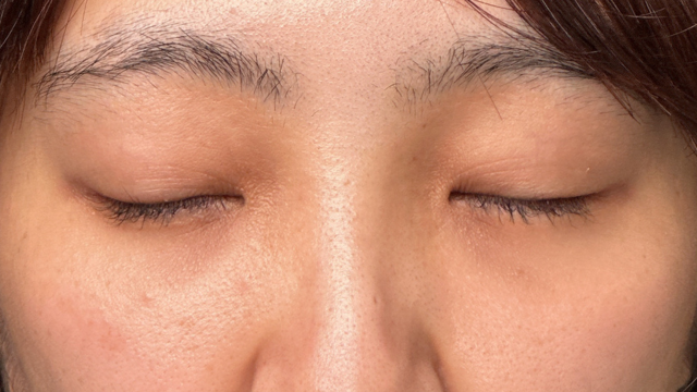 Postoperative Condition Part 1