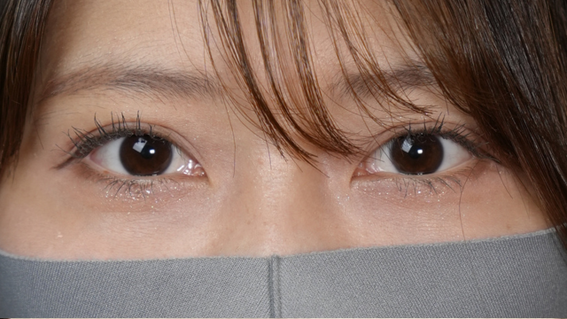 Postoperative Condition Part 1