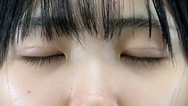 Postoperative Condition Part 1