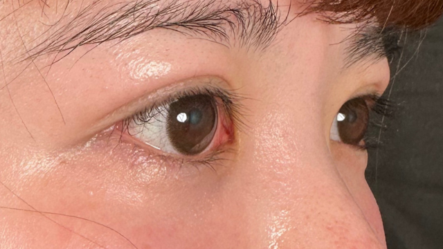 手术前的状态 其一