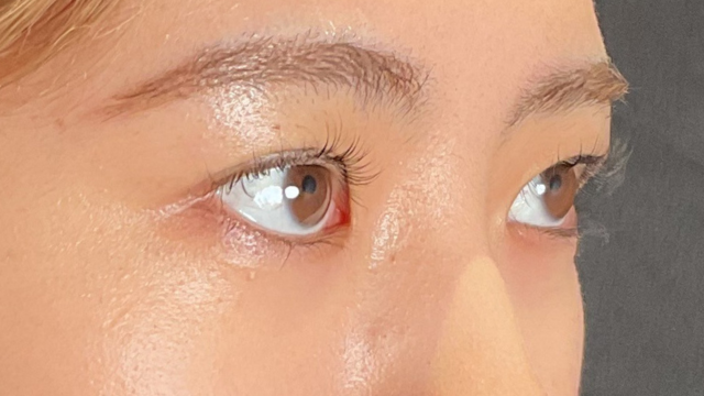 手術前の状態 その1