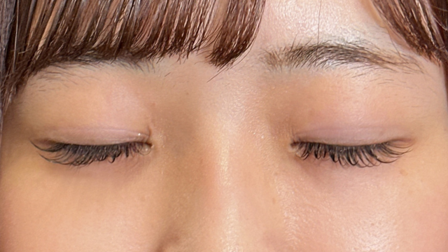 手术前的状态 其一