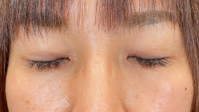 手术前的状态 其一