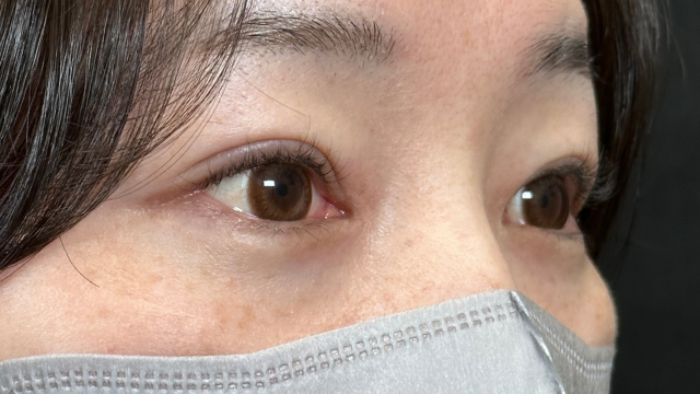 手术前的状态 其一