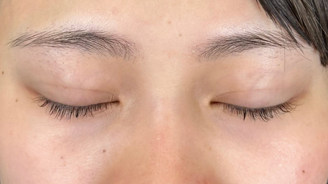 手术前的状态 其一