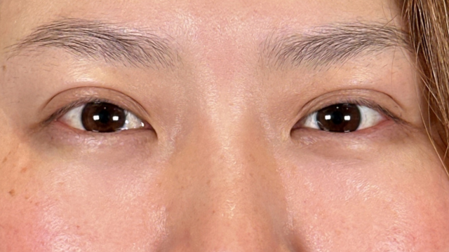 手术前的状态 其一