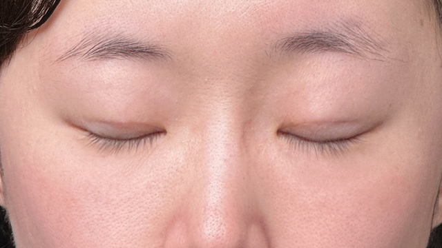 Postoperative Condition Part 1