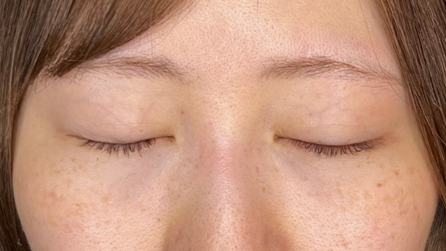 手术前的状态 其一