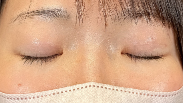 手术前的状态 其一