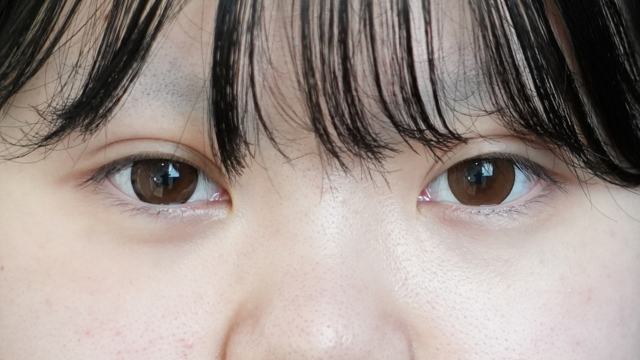 手术前的状态 其一