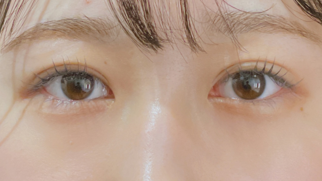 手术前的状态 其一