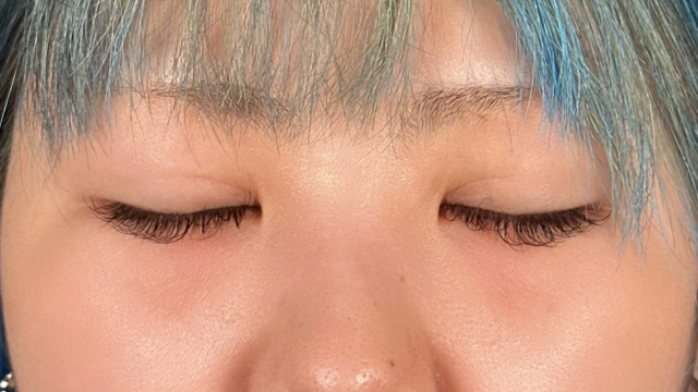 手术前的状态 其一