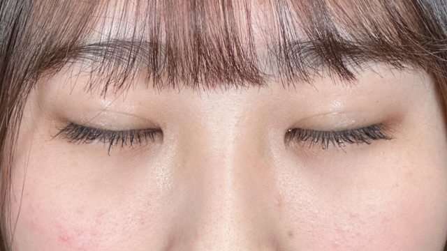 手术前的状态 其一