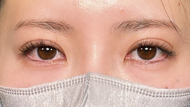 手术前的状态 其一