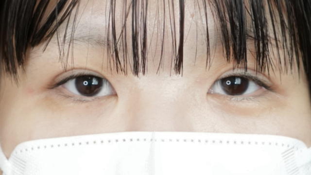 手術前の状態 その1