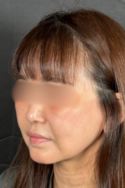 手術前の状態 その1