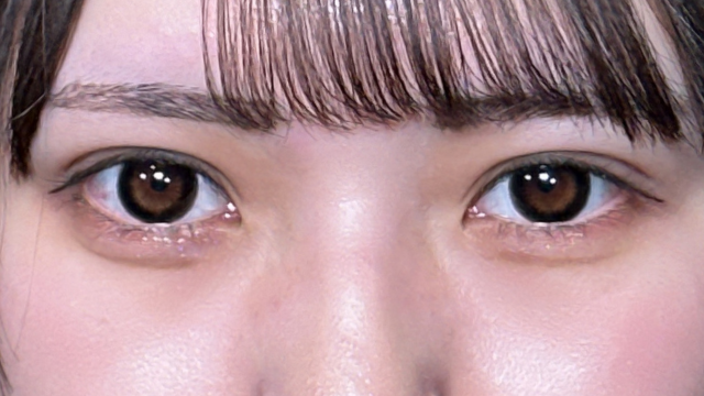 手術前の状態 その1