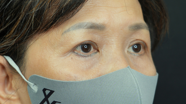 手术前的状态 其一