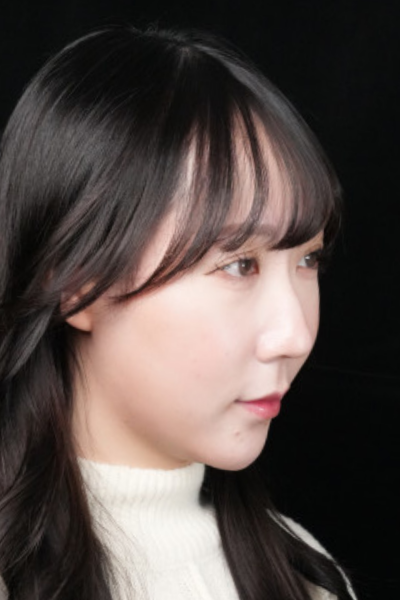 手术前的状态 其一