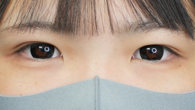 Postoperative Condition Part 1