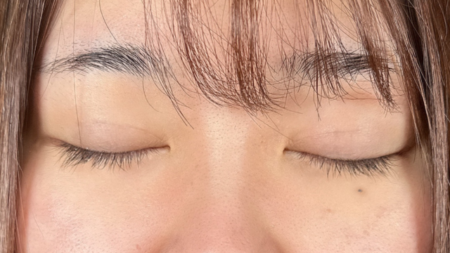 手术前的状态 其一